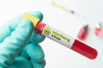 Marburg virus concept: doctor hold a sample of Marburg virus