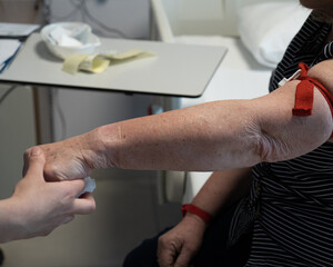 Blood is drawn from the old woman's arm. Blood is taken for tests from the arm of the woman who will have the surgery