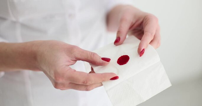 Woman hands hold napkin with red blood closeup. Early periods and causes