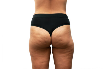 Cropped shot of young tanned woman in black panties with cellulite from a weight loss or weight gain on thighs isolated on a white background. Excess weight, overweight. Stagnation of lymph - obrazy, fototapety, plakaty