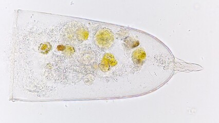 Marine tintinnid ciliate known as Favella sp. Stacked photo