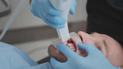 Close up: Doctor scans the teeth of a male patient in the medical office of clinic. The dentist holds in his hand a manual 3D scanner for the jaw and mouth. Dental health