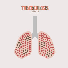 Diagnosis and treatment of lung diseases: tuberculosis, asthma, pneumonias. Lungs health. Medical concept with tiny people. Flat vector illustration.