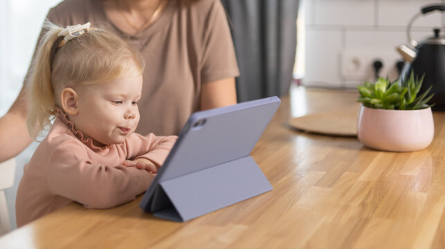 Funny Baby With Cochlear Implant. Hear Aid And Medicine Innovating Technology And Diversity Concept