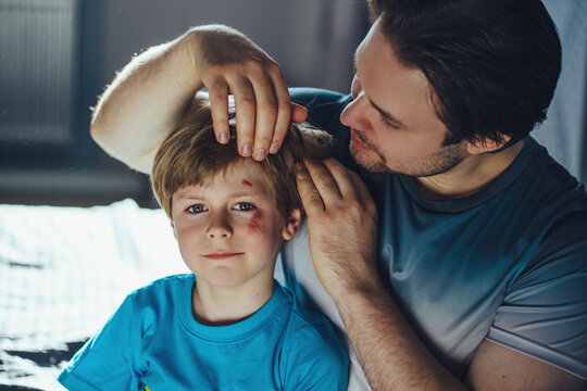 Father inspects his son with scratches on his face after fall
