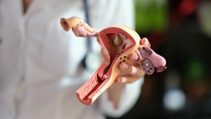 Woman gynecologist holding anatomical model of uterus and ovaries