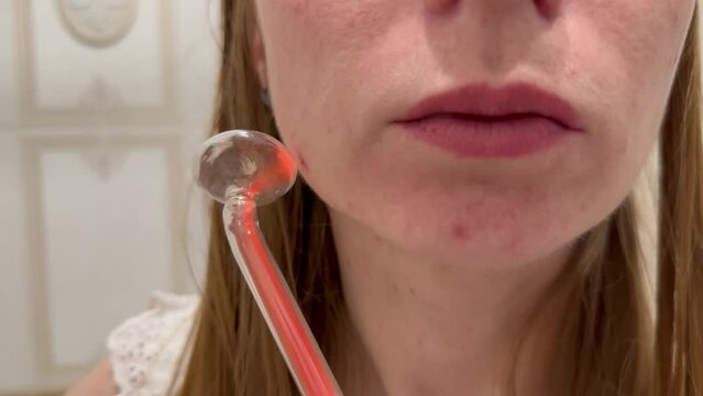 Darsonvalization of the face in a young girl with problem skin.