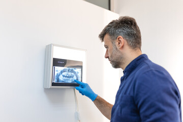 health dental professional in blue scrubs examining dental x-ray on computer screen. Dentists looking to x-ray scan on monitor at dental clinic.