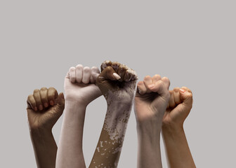 Hands of different people, of diverse race, skin color, gender raising fists up over grey...