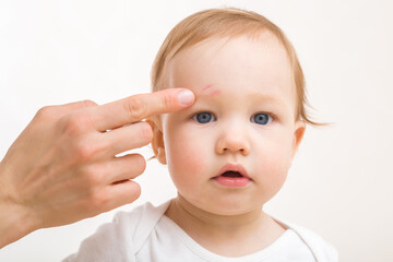 Mother finger pointing to abrasion forehead skin of infant. Isolated on light gray background....