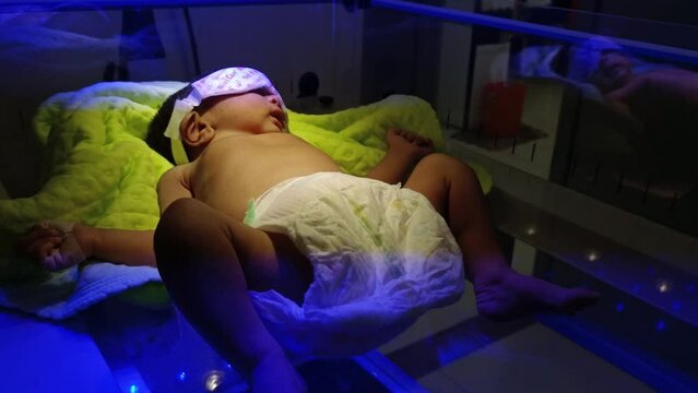 Newborn Baby Photo therapy with Eye mask: Newborn baby on jaundice phototherapy, Newly born baby girl receiving phototherapy for jaundice at the maternity hospital 4K . getting treated for jaundice.