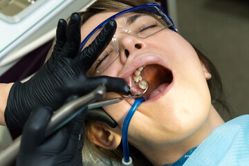 Caries treatment to chewing side tooth upper jaw © Vagengeim