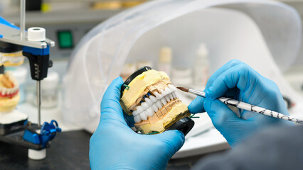 Dental prosthesis work. Teeth painting.