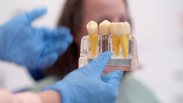 Dental implant model in modern clinic: showing teeth implantation and crown, healthy teeth treatments. 