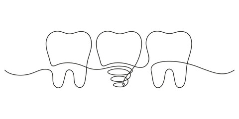 Teeth row with healthy and implant tooth, continuous art line drawing. Dentistry health. Vector hand drawn