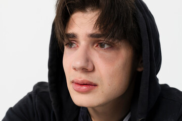 Close-up portrait of a young homeless guy with a bruises under his eyes in dirty, tattered clothing. Isolated on white background.