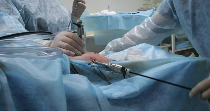 Veterinary surgeon performs endoscopic abdominal surgery on a pet in surgery. The hands of the veterinarian operate the endoscope in surgery. The concept of endoscopic surgery in veterinary medicine.