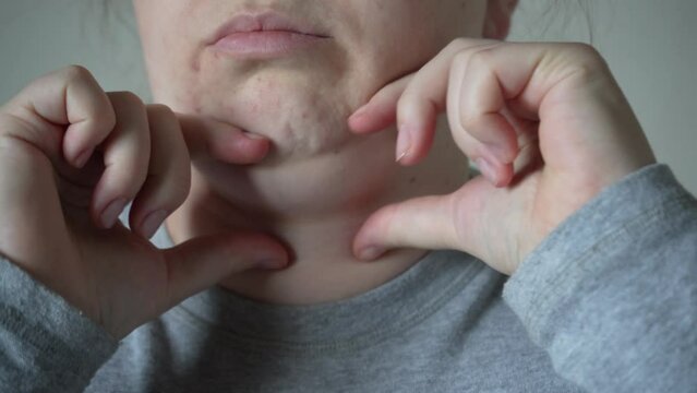 A hand squeezing the layered skin under the neck, problematic sagging of adipose tissue hanging under the chin of a woman, health care concept.