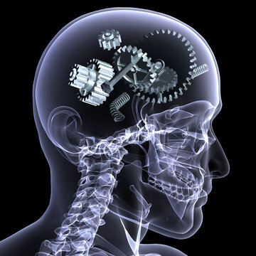 X-Ray of a male skeleton with a series of gears and other parts in his head coming apart. Isolated on a black background