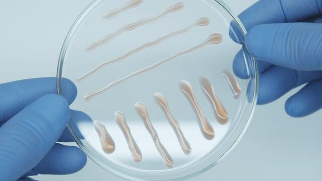 Bacteria culture on a petri dish in microbiology lab. Candida auris. Microbial cultures growth on selective media plate. Biomarker. assistant holds the petri with gloves.