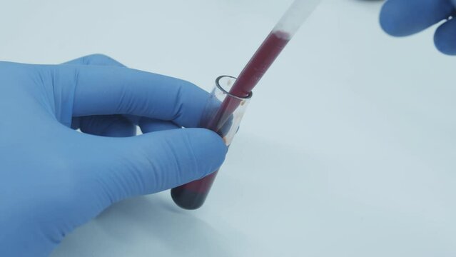For tests requiring serum, a blood sample is drawn into a tube containing no anticoagulant. Hand of scientist holding dna test tube in laboratory.  Deoxyribonucleic acid. Complete blood count. CBC.
