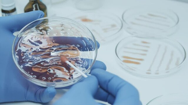 Bacteria culture growth on a petri dish in microbiology lab. Candida auris. Closeup of bacteria culture growth on selective media plate in microbiology laboratory. Biomarker. Bio-reagent.