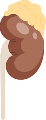 Kidney Diabetic Nephropathy