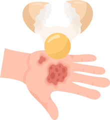 Forbidden Skin Burn Treatment