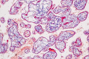 Naklejka premium Histological Uterus human, Uterine tube human, Placenta human and Umbilical cord Human under the microscope for education.