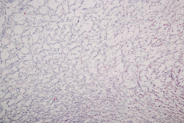 Histological Uterus human, Uterine tube human, Placenta human and Umbilical cord Human under the microscope for education.