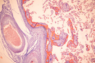 Histological Uterus human, Uterine tube human, Placenta human and Umbilical cord Human under the microscope for education.