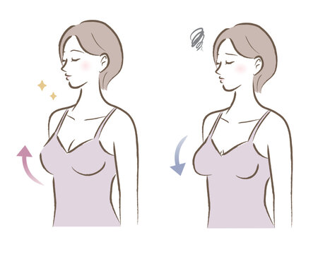 ハリのあるバストと垂れたバストの女性のイラスト　ビフォーアフター	