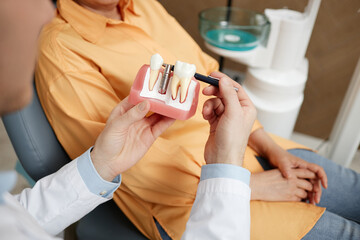 Close-up of unrecognizable dentist holding tooth model while explaining dental implant surgery to...