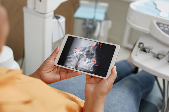Closeup of woman holding digital tablet with tooth X-ray image at dental clinic, copy space