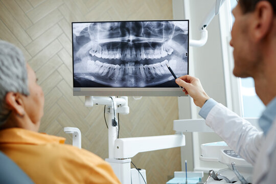 Back view close-up of male dentist pointing at teeth X-ray image on screen during consultation on dental surgery in clinic