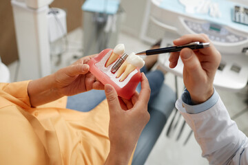 Close-up of unrecognizable senior woman holding tooth model during consultation on dental implant...
