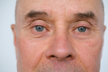 close-up of charismatic mature man, senior 60 years old looks carefully examines wrinkles on face, skin folds, age-related skin changes, aesthetic injection cosmetology, care anti-aging procedures