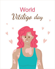 A happy girl with vitiligo. World Vitiligo Day. A woman loves her body. Taking care of herself. Vector flat illustration.