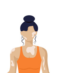 Fototapeta premium light-skinned faceless girl with vitiligo on white background. vector illustration. beauty of a different kind. body positive.
