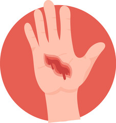 Large And Deep Hand Wound