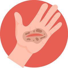Obraz premium Dirt In The Wound On Hand