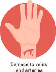 Obraz premium Damage To Veins And Arteries