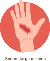 Obraz premium Large And Deep Hand Wound