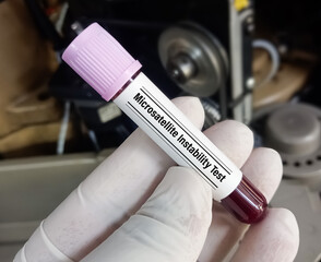 Blood sample for Microsatellite Instability (MSI) test, MSI screening is used to see the function...