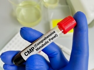 Blood sample tube for analysis of CMP or Comprehensive Metabolic Panel in laboratory.