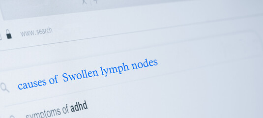 Swollen lymph nodes