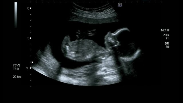 Mother's womb ultrasound during pregnancy. Ultrasound of a fetus at 12 weeks