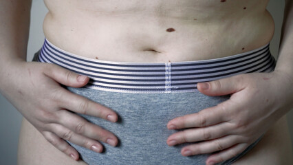 Young overweight or plus size woman with fat big belly, surgery and fat splitting concept, xl size people life, fat and fat concept.