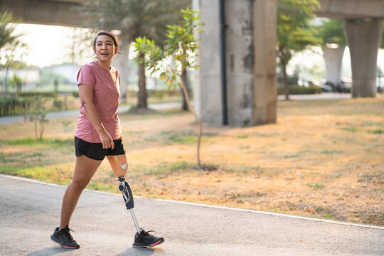 Exercise woman with prosthetic leg in the park