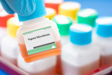 Vaginal Microbiome